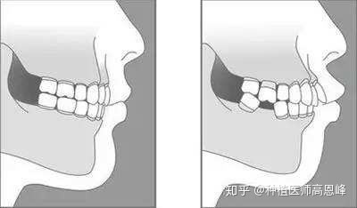 口腔医学对社会和生活有什么用